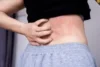 Rashes in Your Private Area: Causes, Types, and Effective Treatments - Post Thumbnail